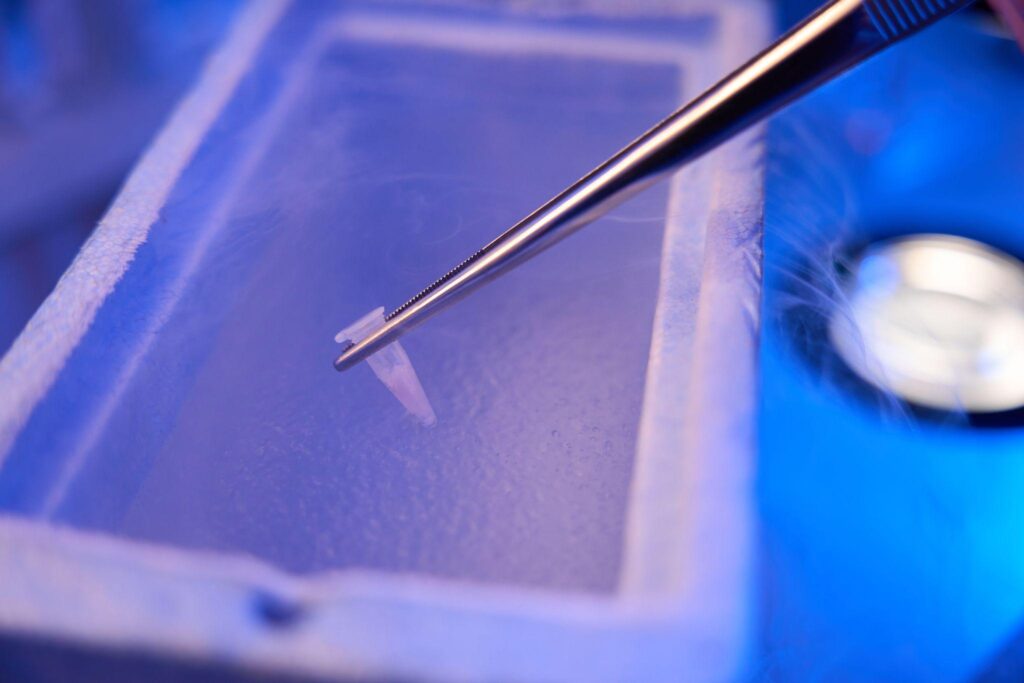 Egg Freezing Costs in Murrieta & Beverly Hills
