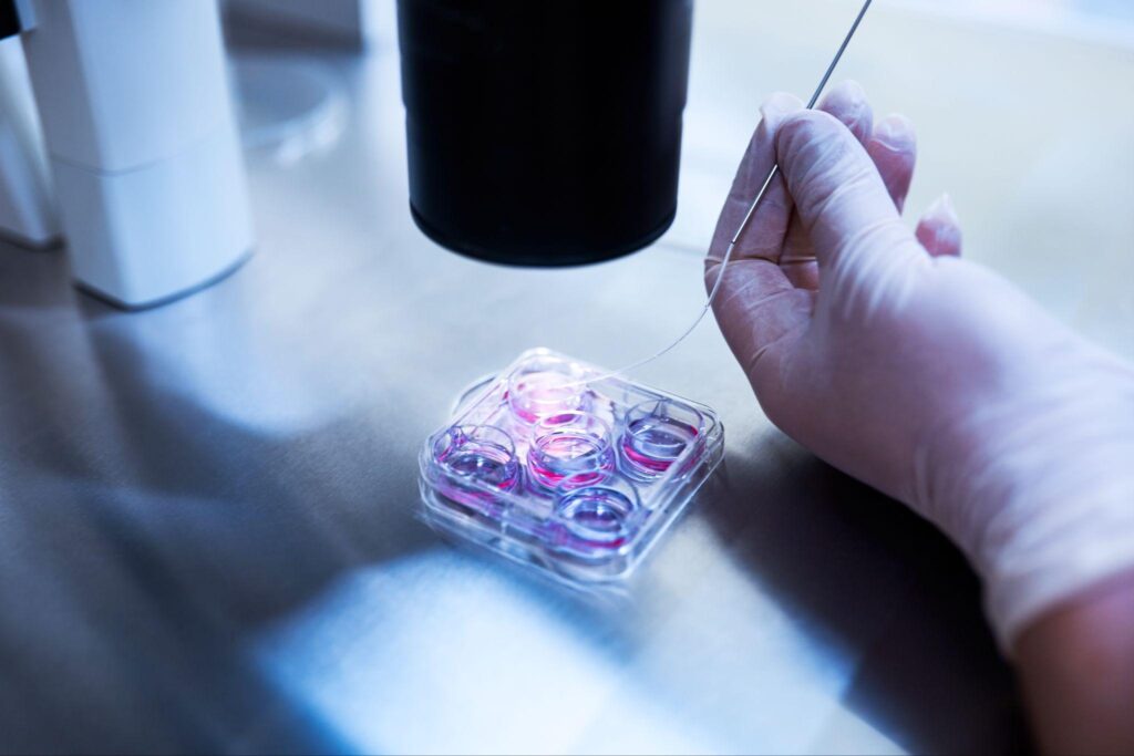 Core Egg Donor Requirements in Los Angeles