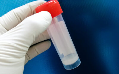 Semen Analysis in Murrieta & Beverly Hills: Get Accurate Results