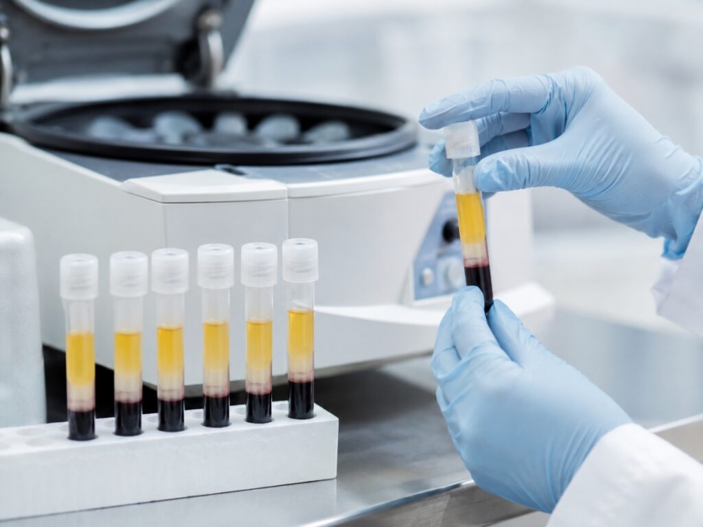 What Is Platelet Rich Plasma Fertility Therapy?